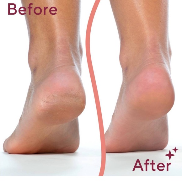 Finishing touch flawless electric pedi tool - Picture 2 of 4